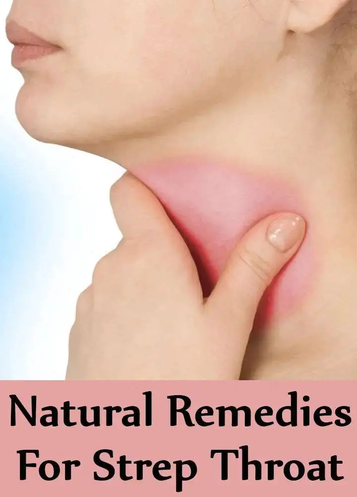 10 Best Natural Remedies For Strep Throat