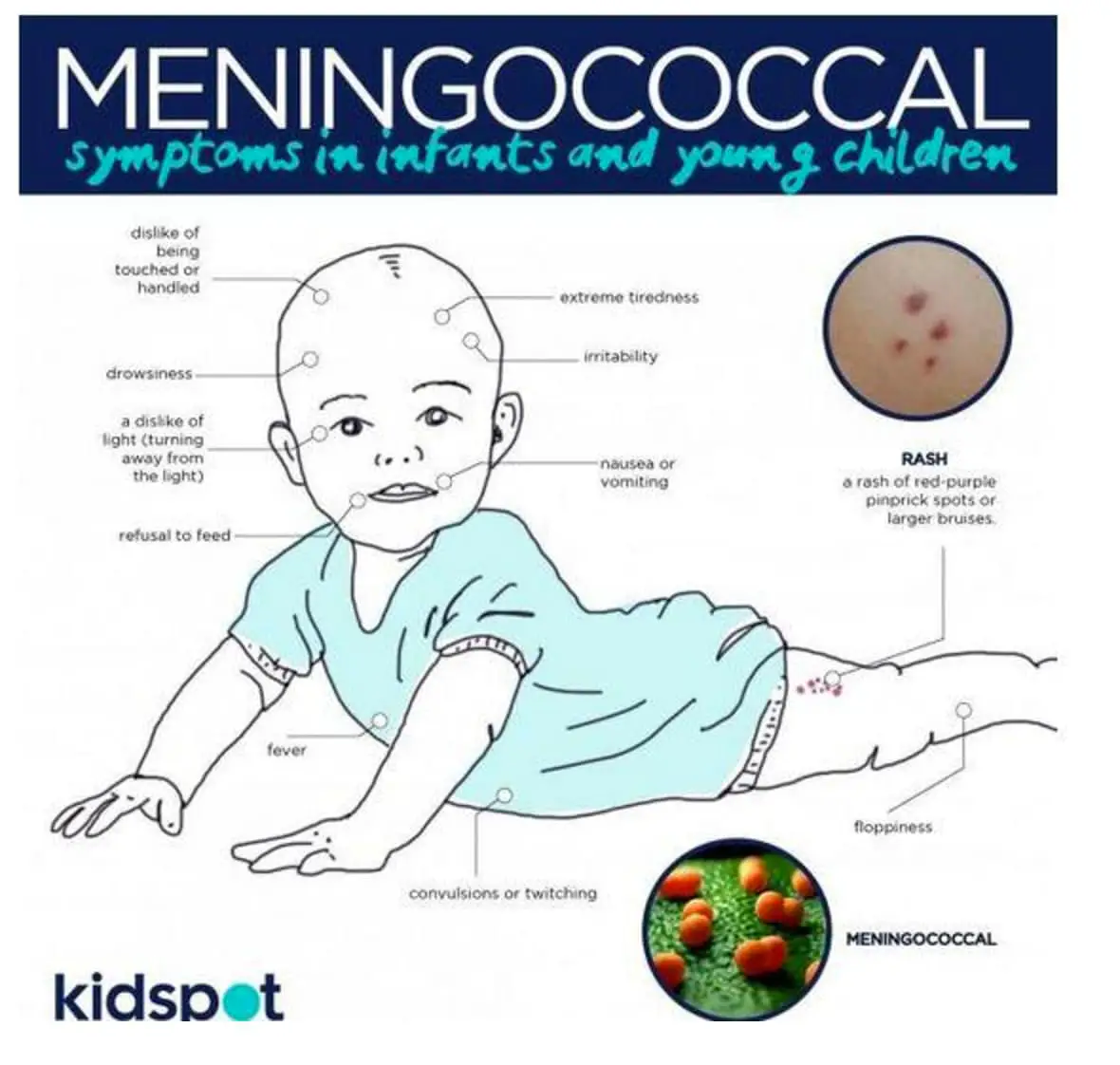 10 meningococcal facts that could save your kids life