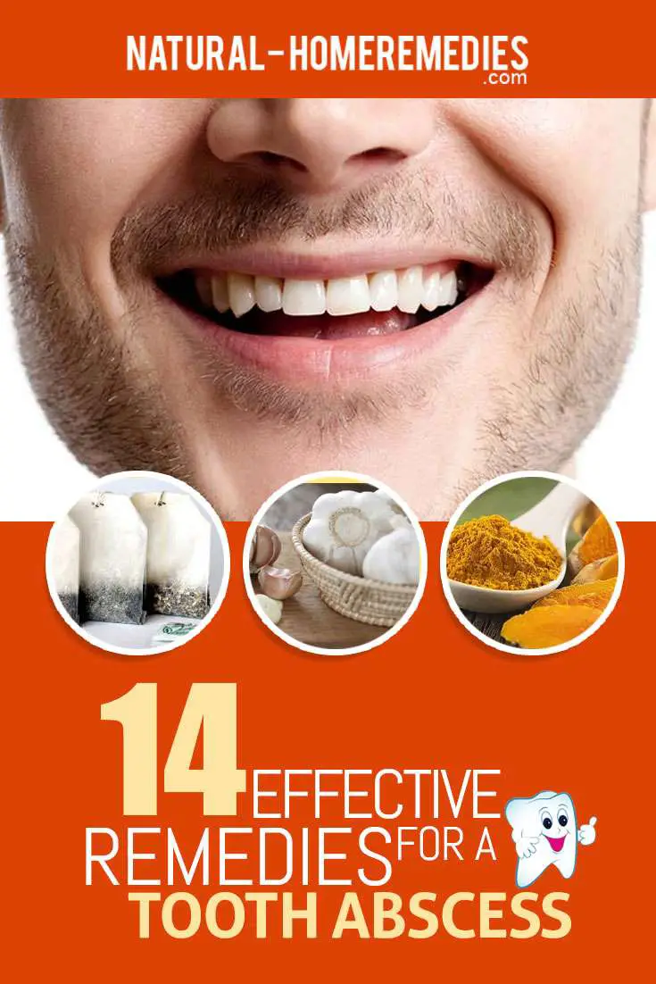 14 Effective Remedies For A Tooth Abscess  Natural Home ...