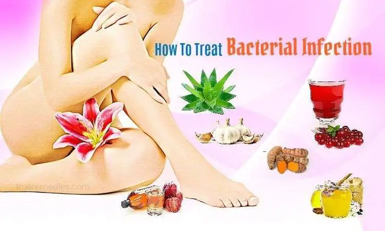 36 Tips On How To Treat Bacterial Infection Without ...