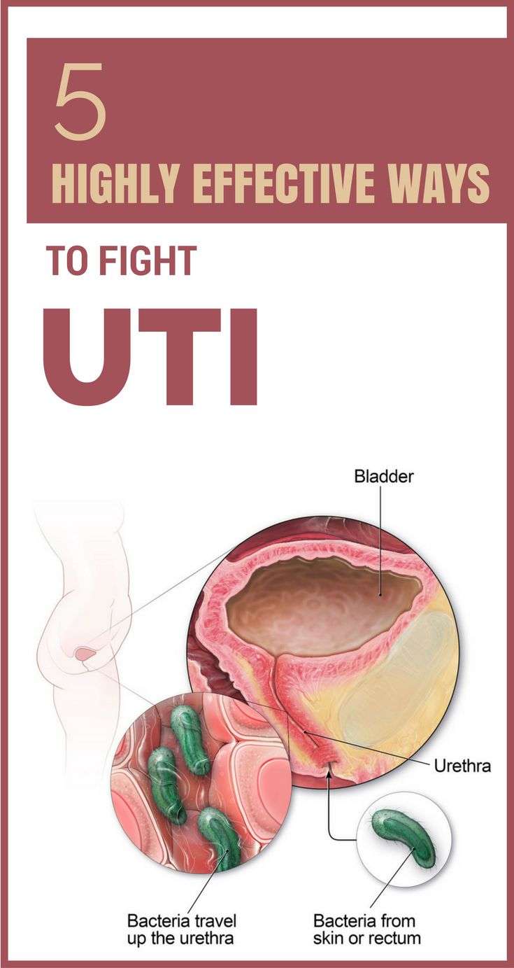 5 Highly Effective Ways to Fight UTI