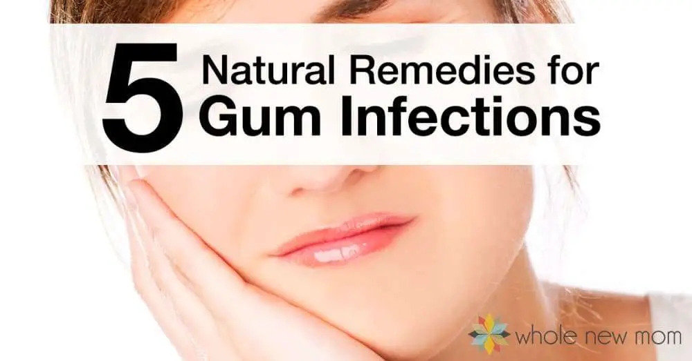 5 Natural Remedies for Gum Infections That Really Work ...