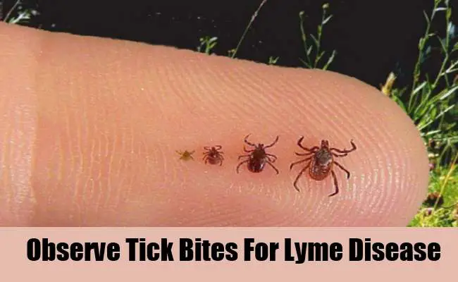 5 Symptoms &  Treatment Of Lyme Disease