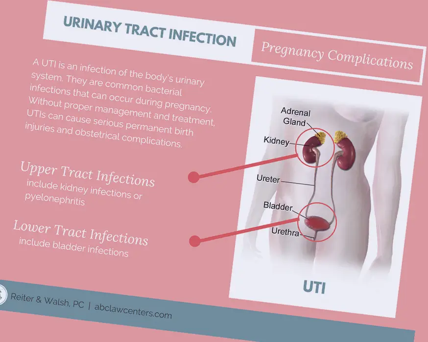 7 Natural Home Remedies To Treat Your UTI Quickly, And ...
