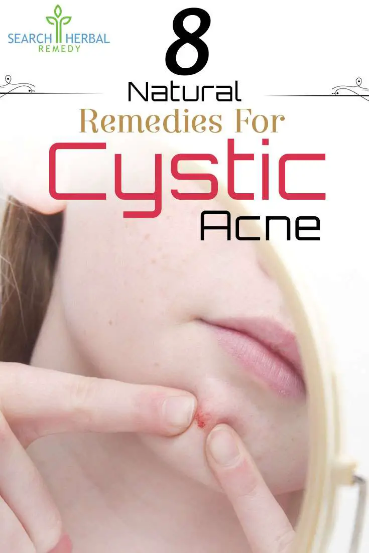 8 Natural Treatments For Cystic Acne