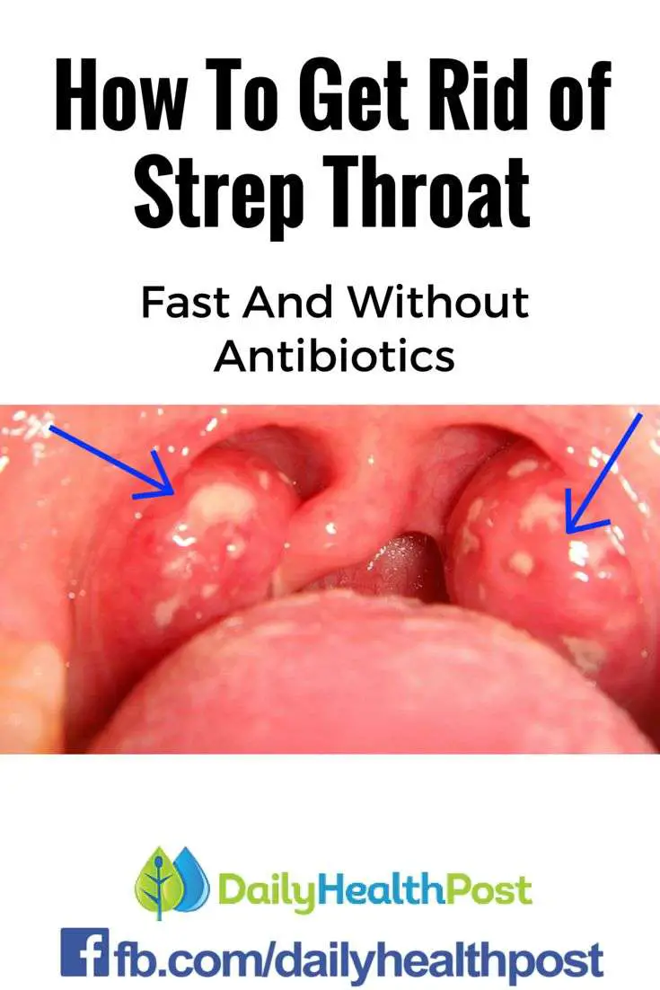 A painful and inflamed throat is a good indication that ...