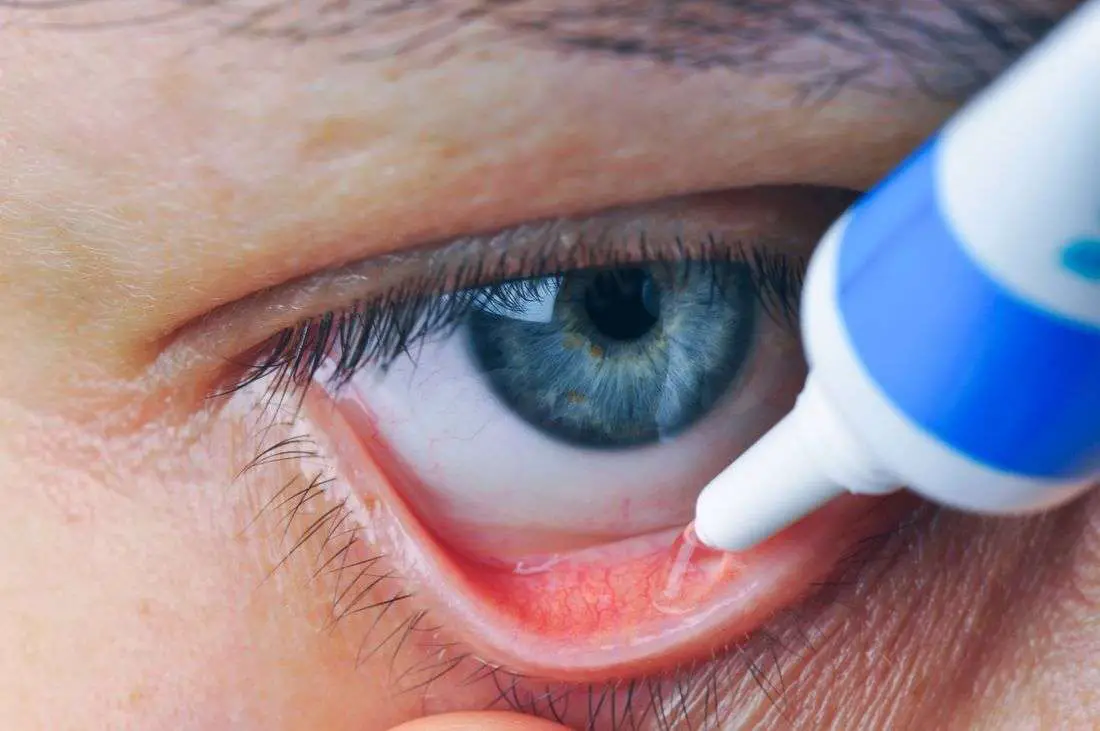 Antibiotic Eye Ointments: Uses, Side Effects, Dosages
