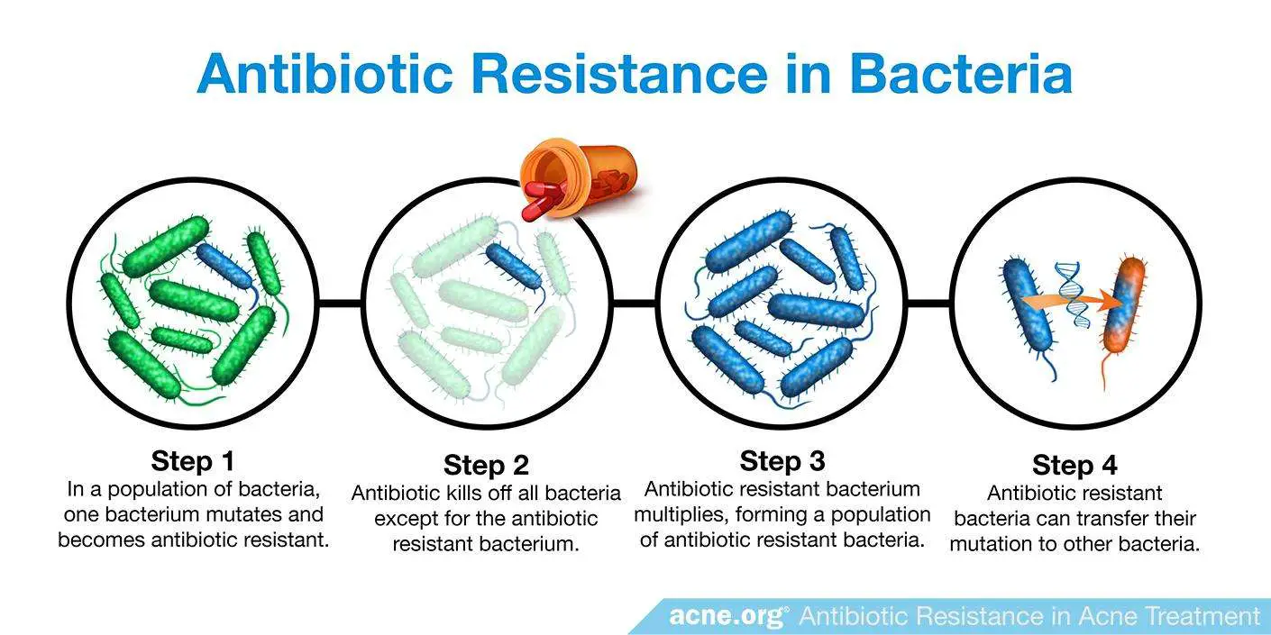 Antibiotic Resistance in Acne Treatment