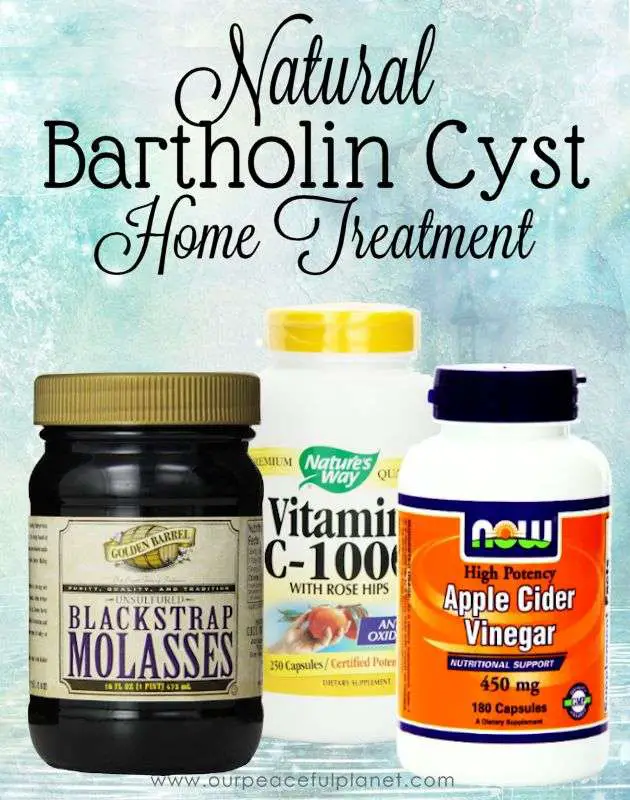 Best 25+ Bartholin cyst treatment ideas on Pinterest
