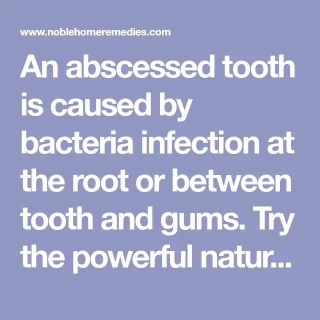 Best Natural Antibiotics Tooth Abscess: Symptoms and Treatments ...
