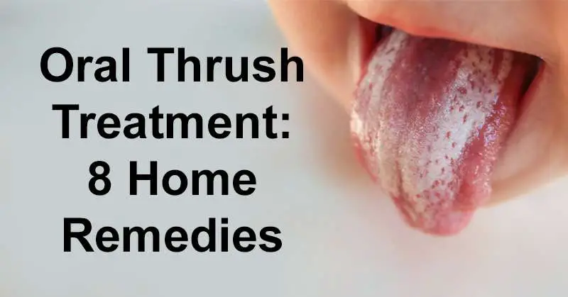 Can antibacterial mouthwash cause oral thrush â Health News