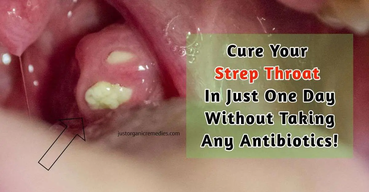 Can Strep Make Your Teeth Hurt