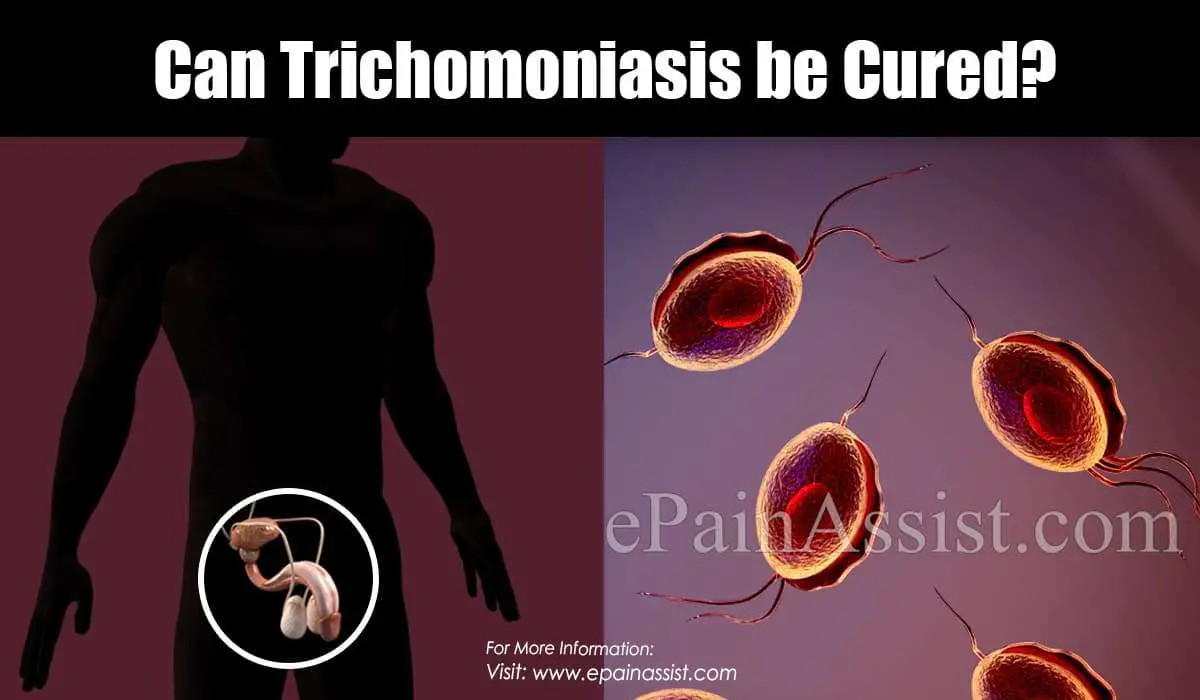 Can Trichomoniasis be Cured?