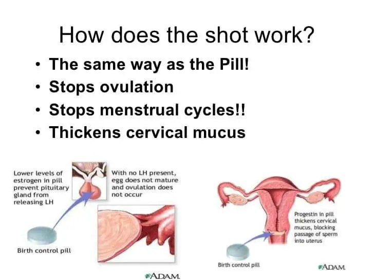 Contraception presentation