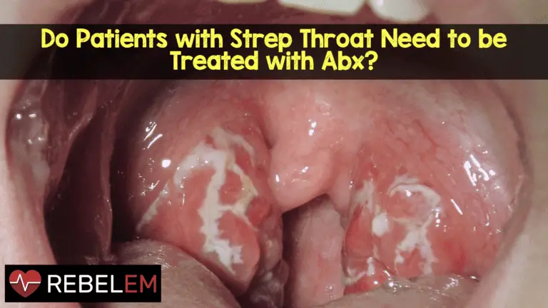 Do Patients with Strep Throat Need to Be Treated with ...