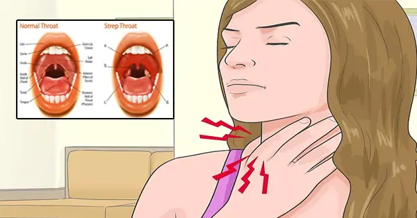 Find out how you can cure strep throat in just one day ...