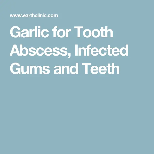 Garlic for Tooth Abscess, Infected Gums and Teeth