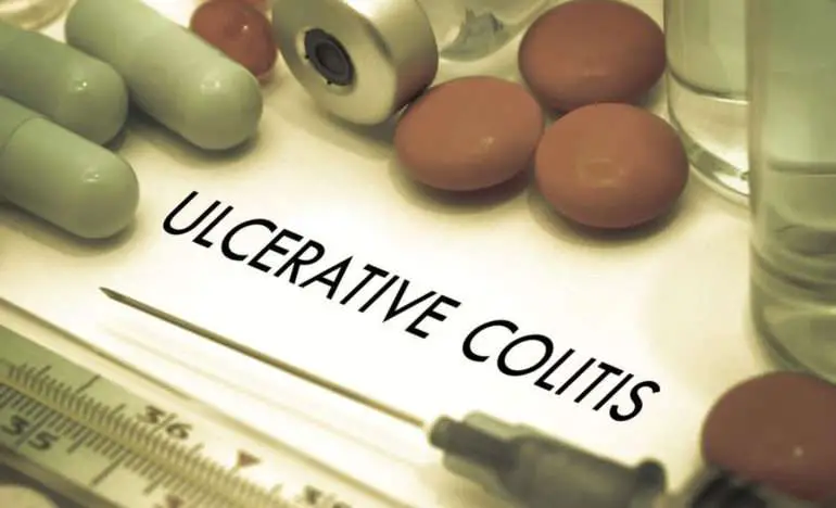 Here Are Some Of The Popular Ulcerative Colitis Treatments ...