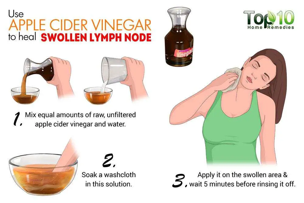 Home Remedies for Swollen Lymph Nodes