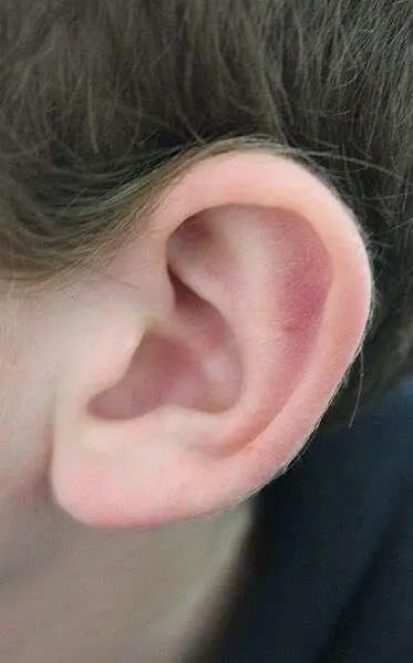 Homeopathic Treatment for Ear Infections Better than Antibiotics ...