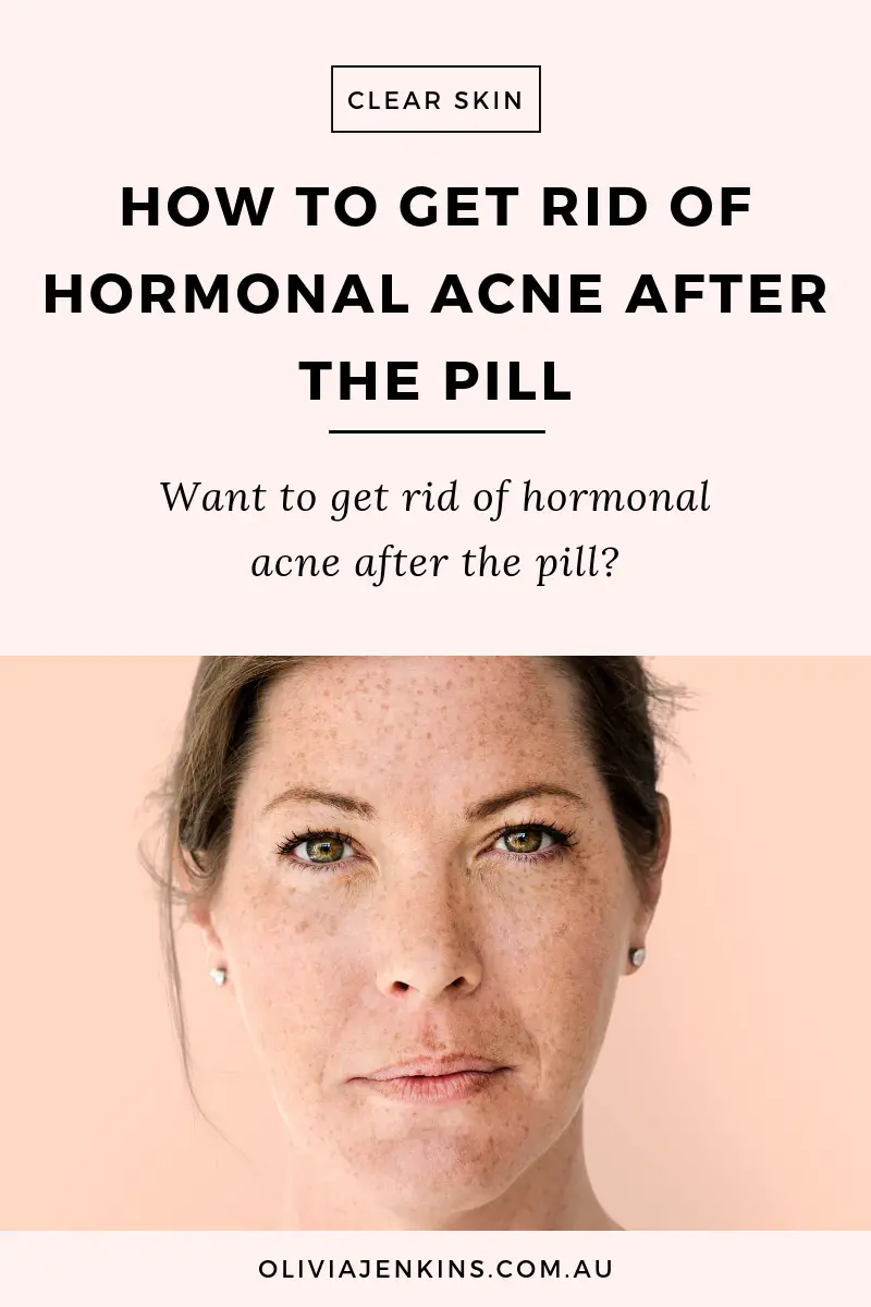 Hormonal acne going off pill diet â Diet Blog