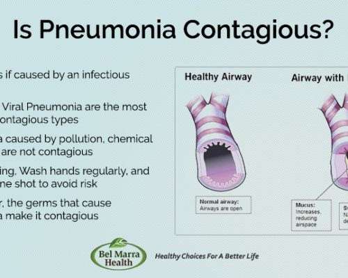 How Long After Antibiotics Are You Contagious With Pneumonia ...