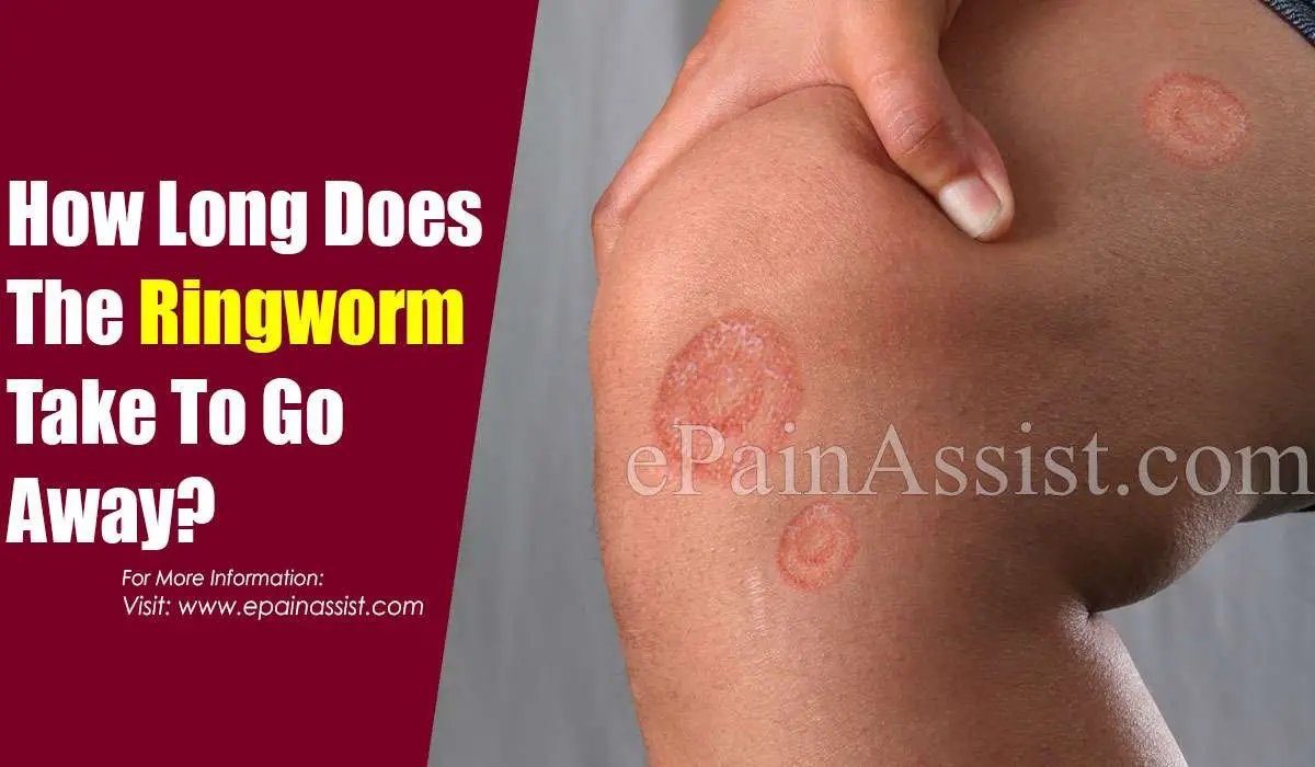 How Long Does It Take For Ringworm To Go Away &  How to Prevent the ...
