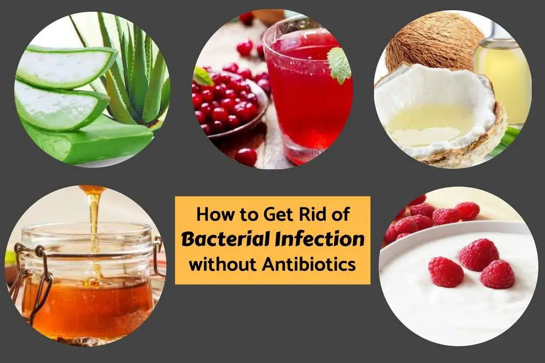 How To Get Rid Of A Bacterial Infection Without Antibiotics
