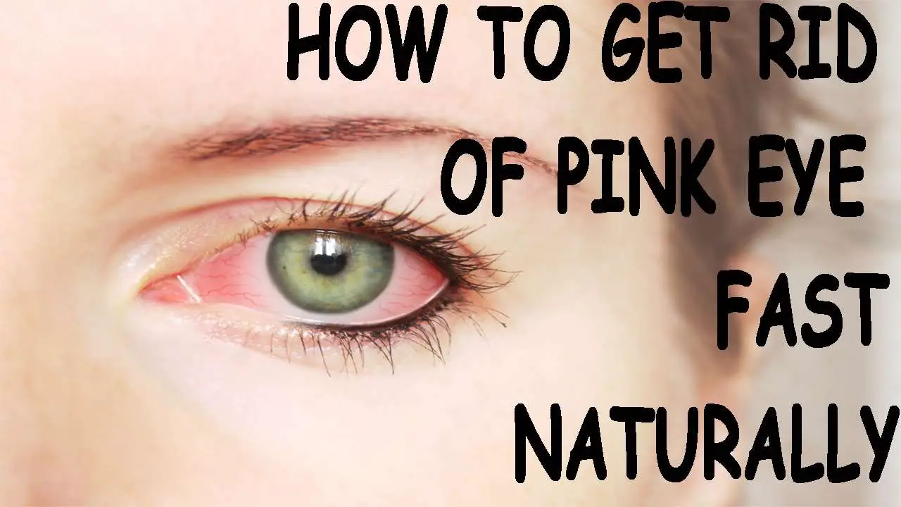 How to Get Rid of Pink Eye Fast