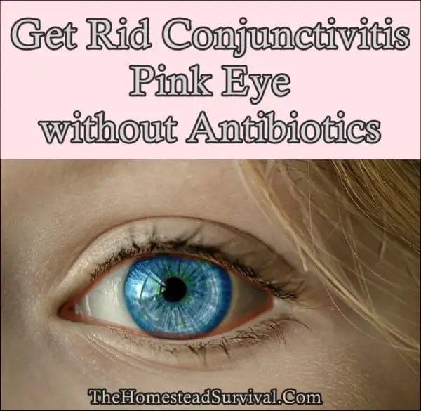 How To Get Rid Of Pink Eye Naturally