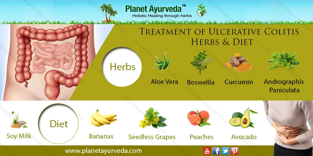 How to Treat and Prevent Ulcerative Colitis Flares Naturally