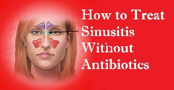 How to Treat Sinusitis Without Antibiotics