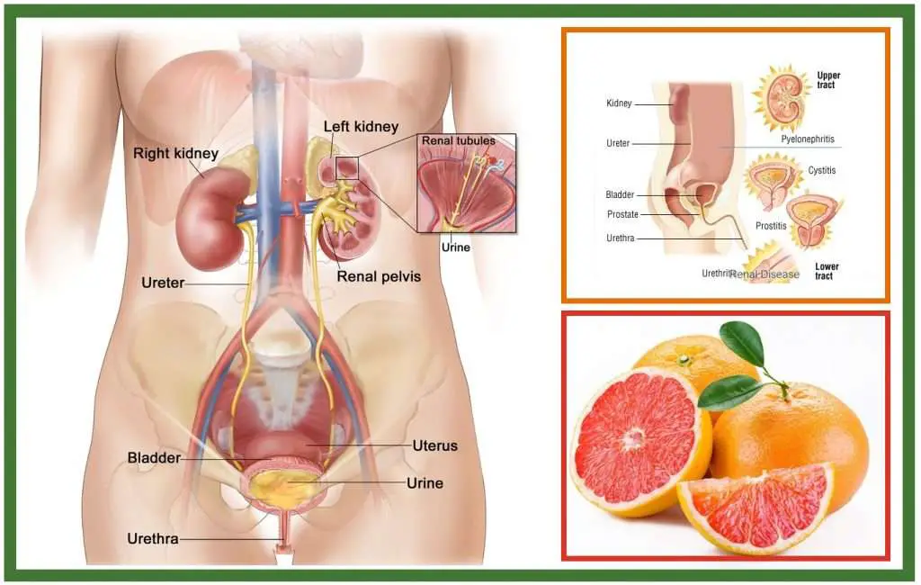 How to Treat Urinary Tract Infections at Home Using Grapefruit Seeds ...