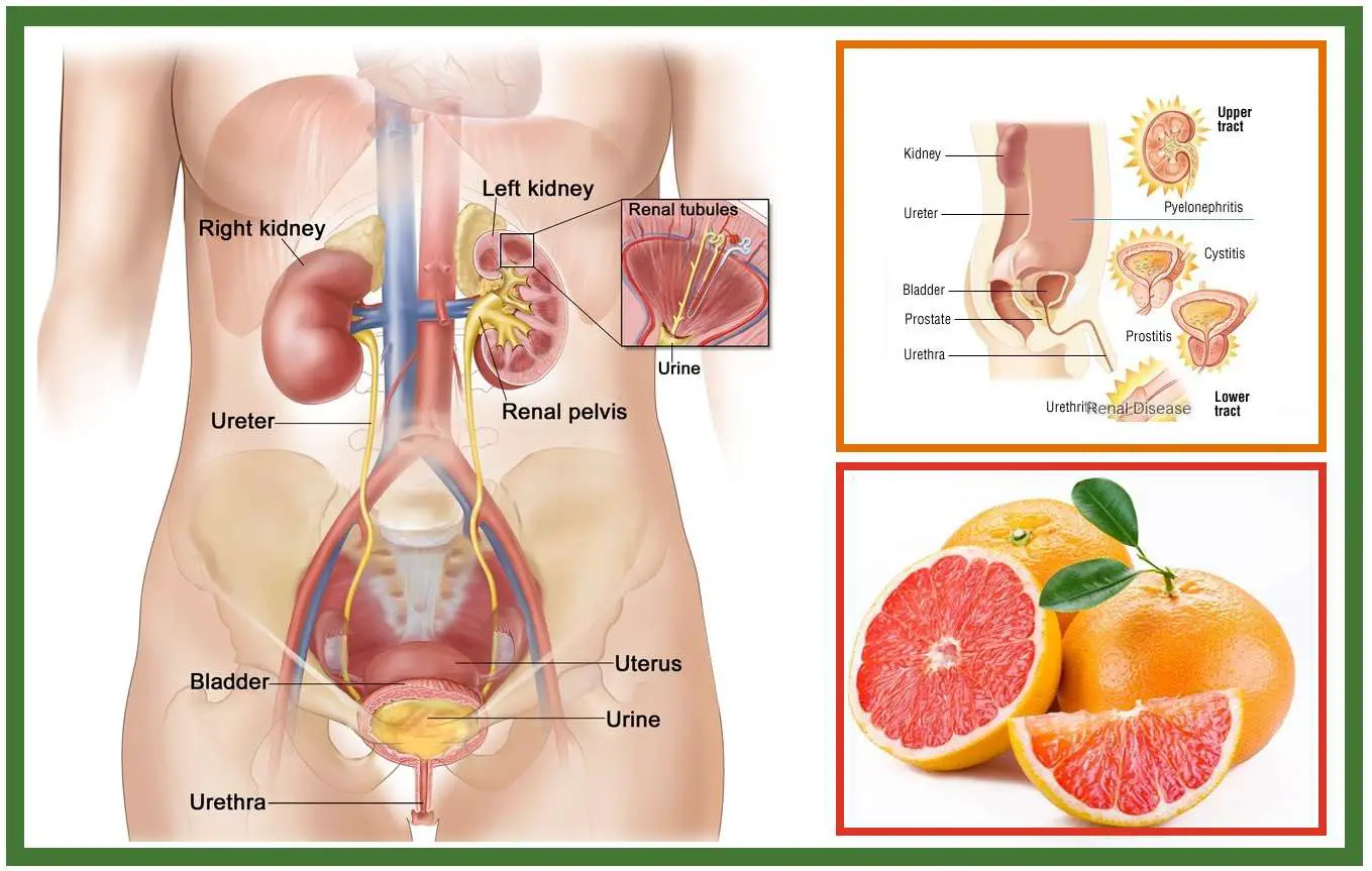 How to Treat Urinary Tract Infections at Home Using ...