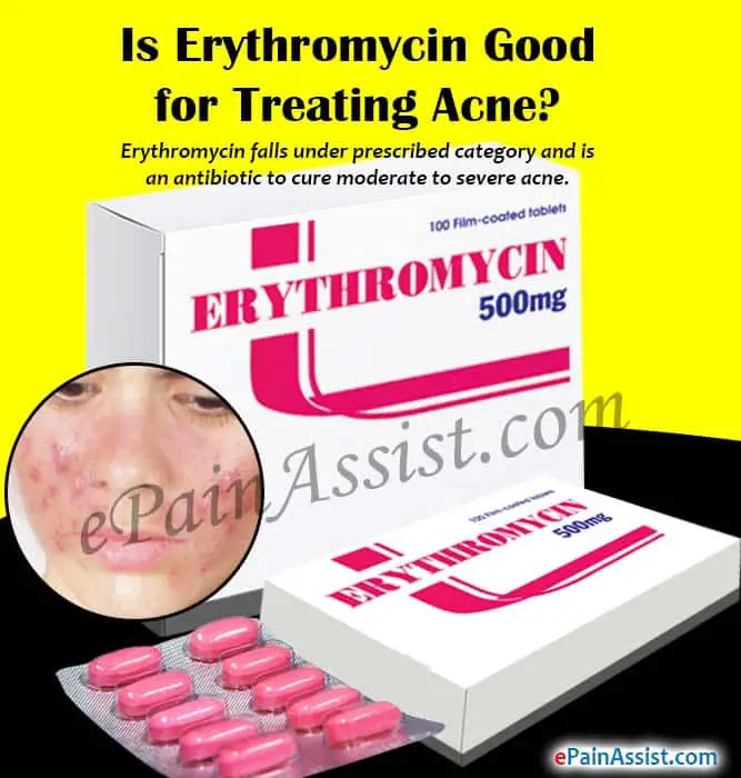 Is Erythromycin Good for Treating Acne?