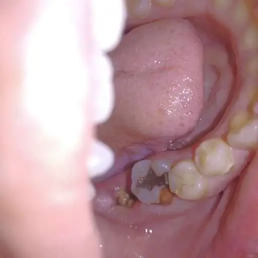 Is my socket infected?