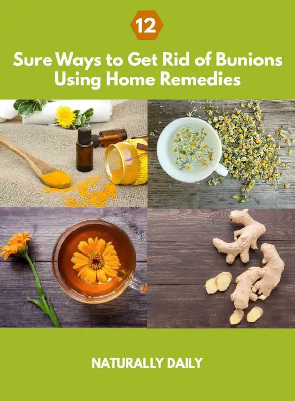Learn how to get rid of bunions fast at home naturally ...