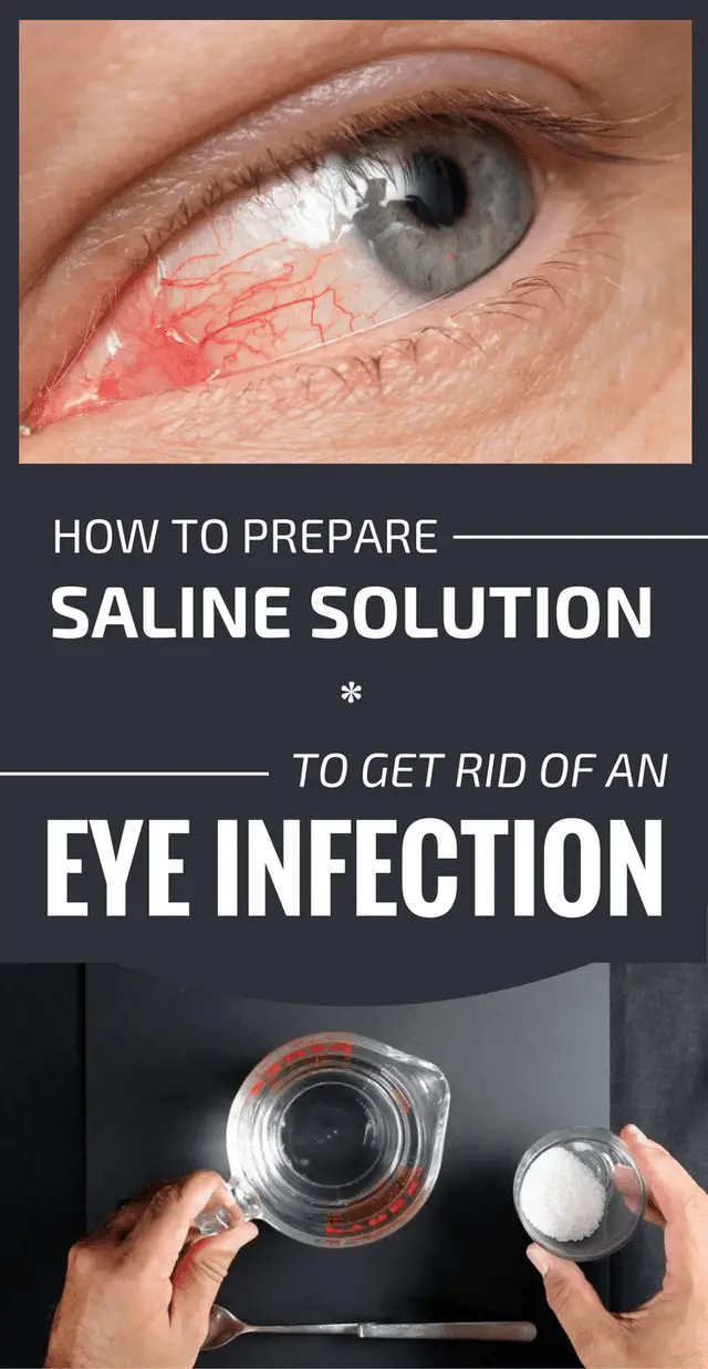Let Start Slim Today: How To Prepare Saline Solution To ...