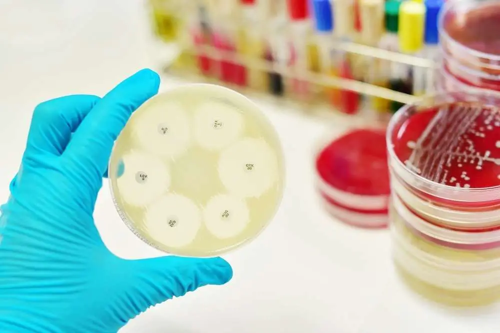 Microbiology Labs Play an Important Role in Antimicrobial ...