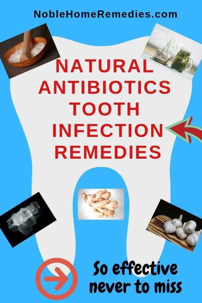 Natural Antibiotics Tooth Abscess in 2020