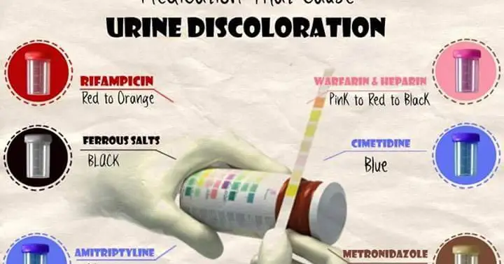 NURSEupdate: Drugs that causes Urine color change