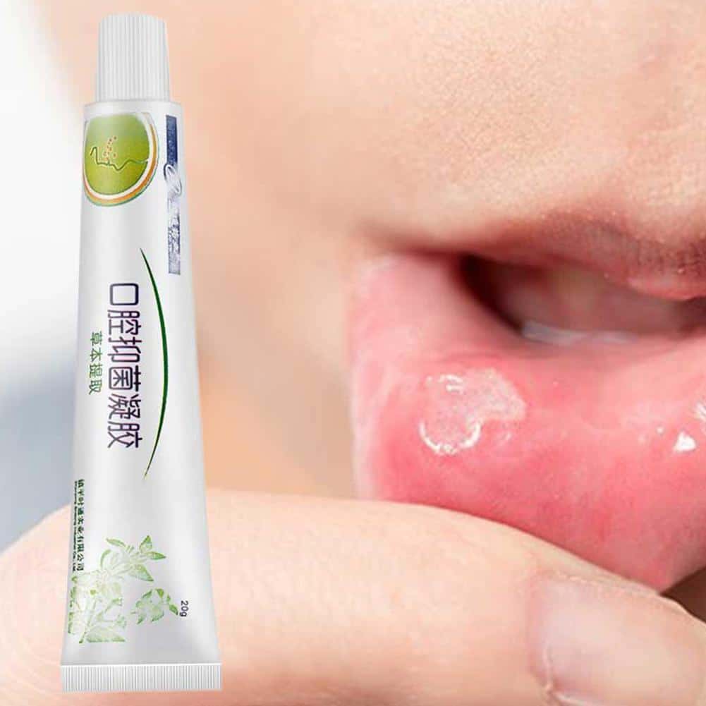 Oral Antibacterial Cream Relief From Pain Mouth Ulcer Relief Gel Easy ...