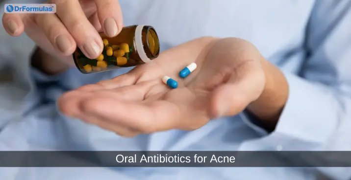 Oral Antibiotics for Acne