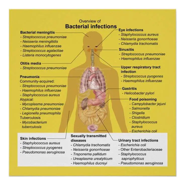 Overview of Bacterial Infections Poster