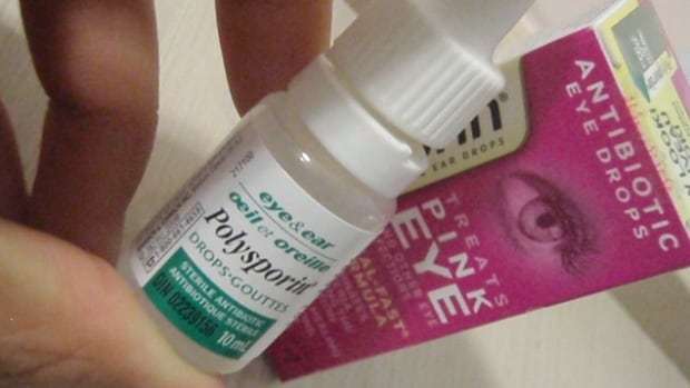 Pinkeye medication in short supply on P.E.I.