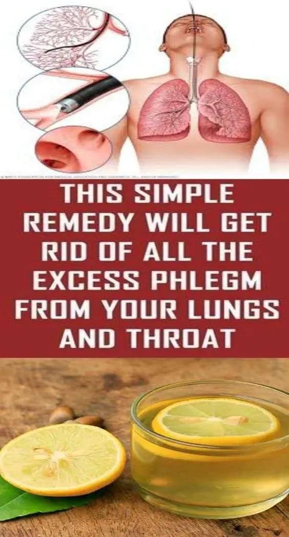 THIS SIMPLE REMEDY WILL GET RID OF ALL THE EXCESS PHLEGM ...