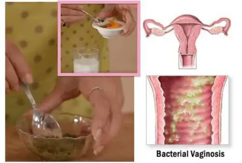 This Woman Shows Her Method How To Cure Bacterial ...