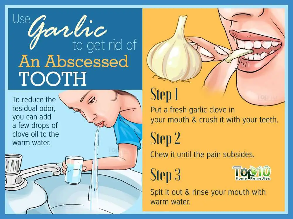 Tooth Abscess: 10 Home Remedies to Help Manage the ...