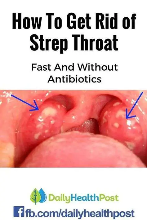 Ultimate Guide To Combat Warning Signs Of Strep Throat â eval