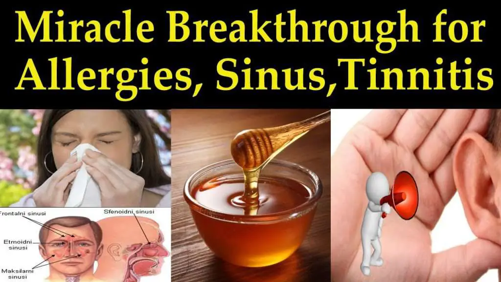 Video: Miracle Breakthrough for Allergies, Sinusitis, &  Tinnitus ...